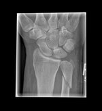 Ulna_21.10.22.jpg